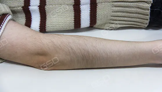 Öncesi 2